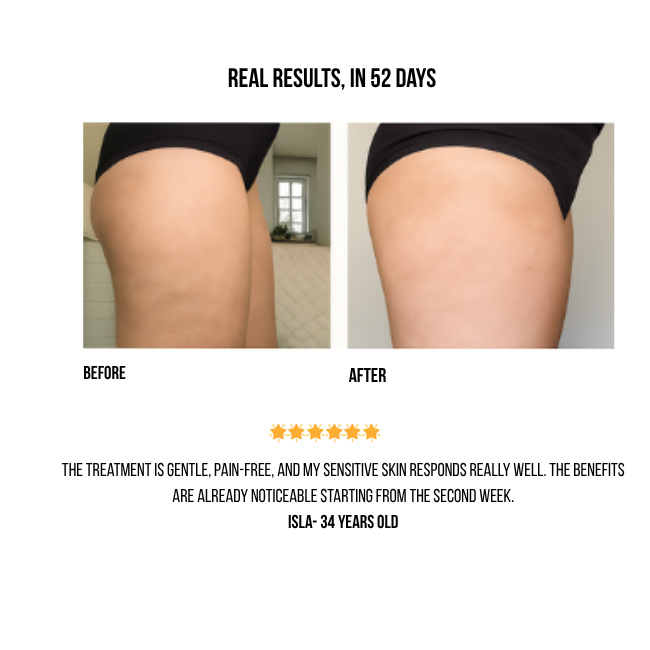 CelluGone™ 3-in-1 Anti-Cellulite Massager | Cupping, Heating & Massage | 12 Suction Levels | Portable, USB Rechargeable & Easy to Use at Home