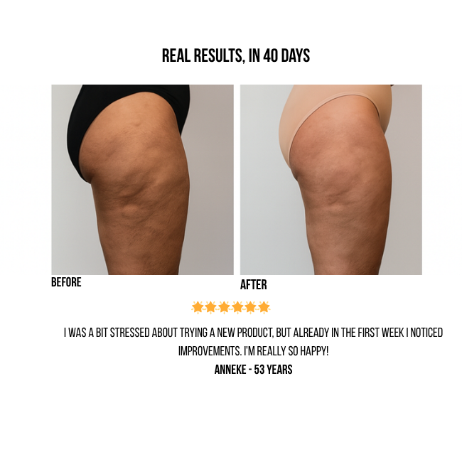 CelluGone™ 3-in-1 Anti-Cellulite Massager | Cupping, Heating & Massage | 12 Suction Levels | Portable, USB Rechargeable & Easy to Use at Home